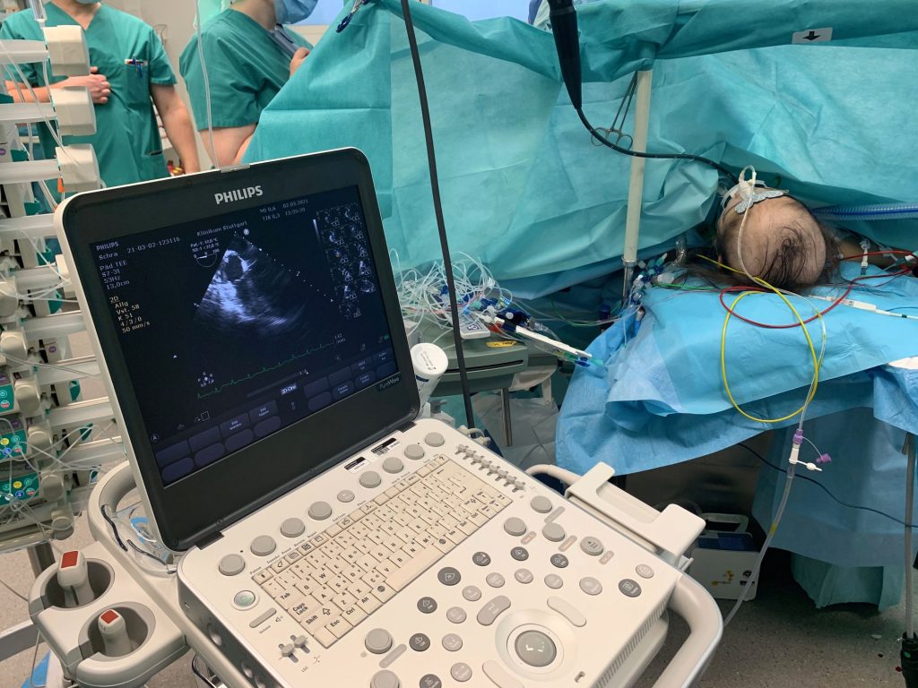 Ultraschallgerät CX 50