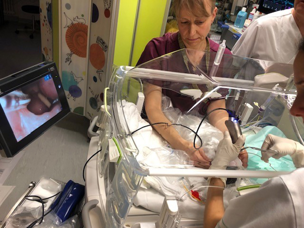 Neues Videolaryngoskop für die Neonatologie